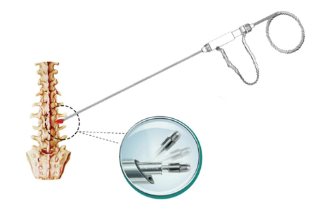 High-frequency surgical equipment RFS-4000KD