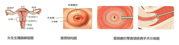 High-frequency surgical equipment RF-90