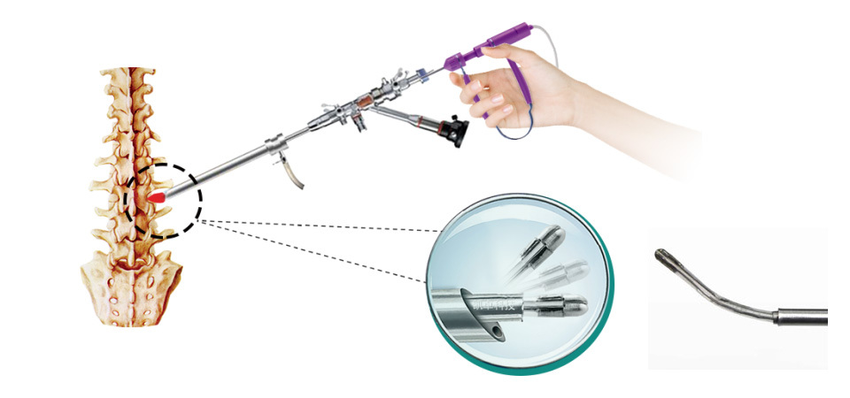 Disposable bipolar high-frequency surgical electrode