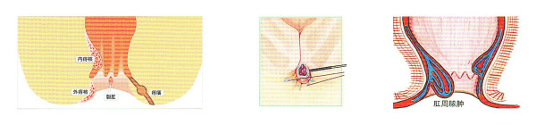 High-frequency surgical equipment RF-90