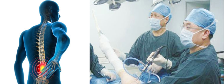 Radio Frequency and Plasma Surgery System PRF-300