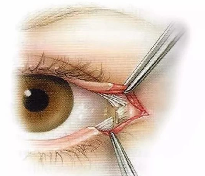 Ophthalmology